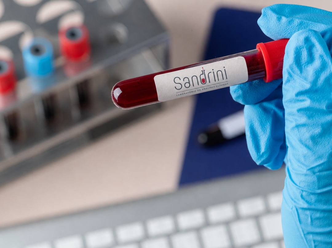 Laboratório Sandrini abrirá atendimento à comunidade na unidade da Karsten, em Blumenau