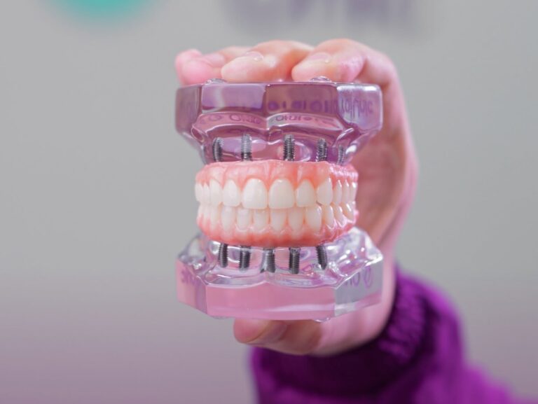 Especialista explica alternativas para reabilitação oral após perda dentária