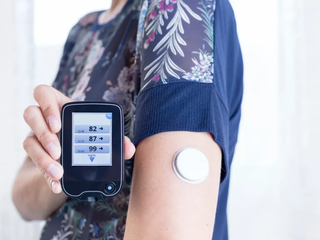Pomerode prepara disponibilização de sensores de glicemia para crianças e adolescentes